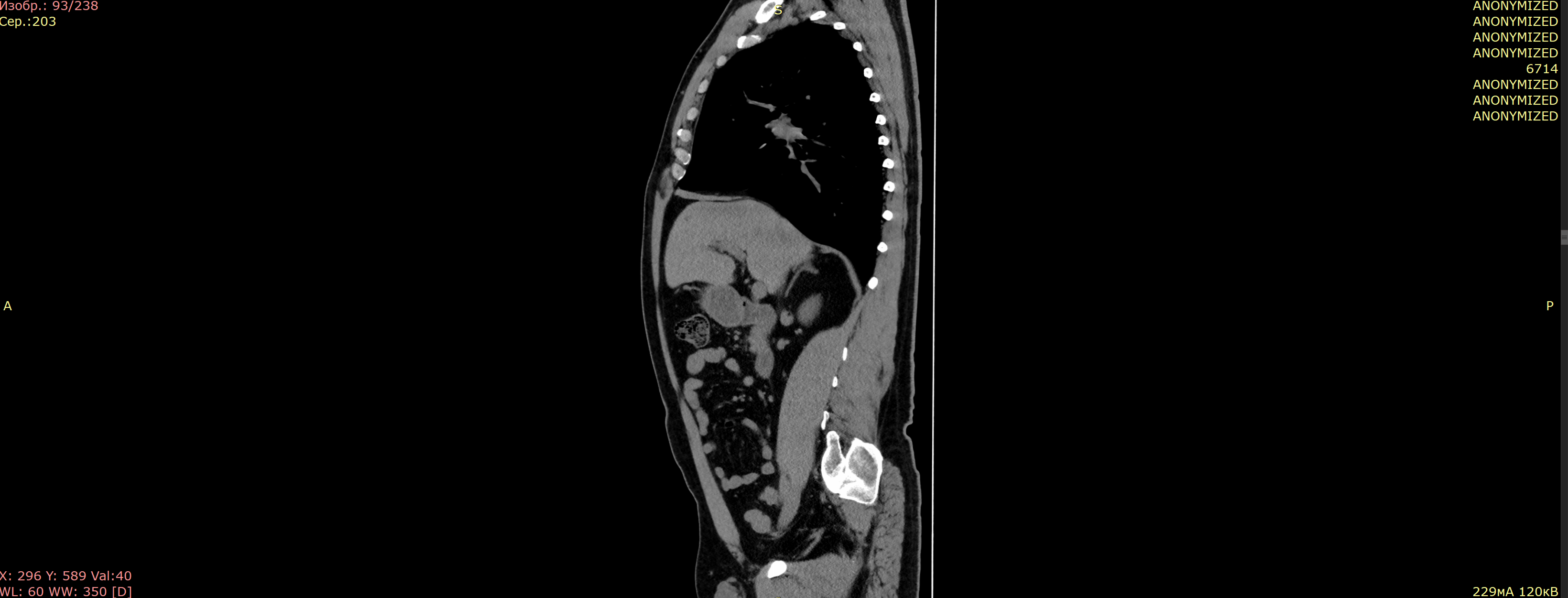 Пример анонимизации DICOM